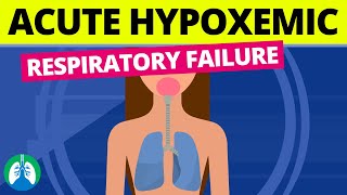 Acute Hypoxemic Respiratory Failure Medical Definition [upl. by Ruzich]