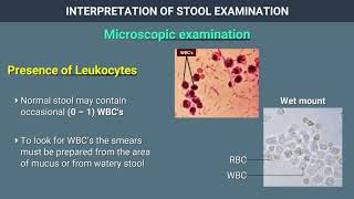 Interpretation of Stool Examination [upl. by Elroy]