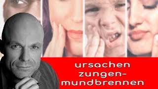 ursachen und therapie für zungen und mundbrennen [upl. by Atsirtal]