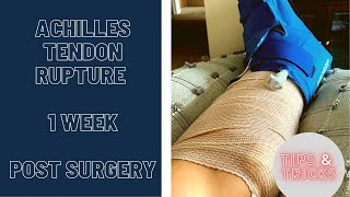 Achilles Tendon Rupture  1 Week  POST SURGERY  2021 [upl. by Linda891]