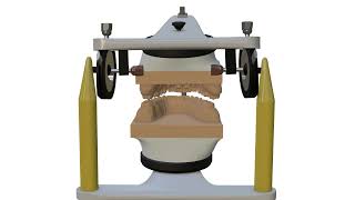 Occlusion Articulator parameters [upl. by Crocker]