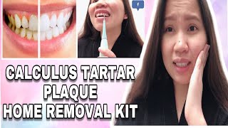 HOW TO REMOVE CALCULUS TARTAR PLAQUE AT HOME  ItsSarahG T [upl. by Olivia]