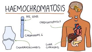 Understanding Haemochromatosis [upl. by Bondy]