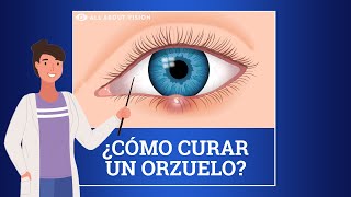 Orzuelo Perrilla en El Ojo Causas y Tratamiento [upl. by Hailed]