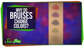 Why Do Bruises Change Colors [upl. by Penelope885]