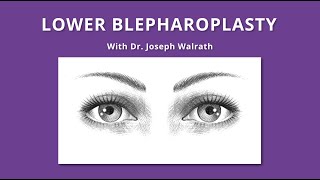 Lower Blepharoplasty [upl. by Livesay650]