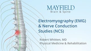 Electromyography EMG amp Nerve conduction studies NCS [upl. by Anelrac822]