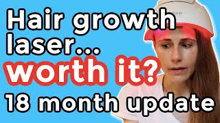 iRestore hair growth laser 18 month update Is it worth it Dr Dray [upl. by Santini]