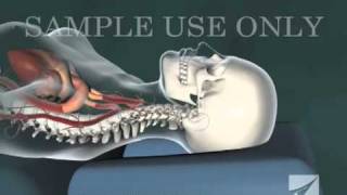 Cervical Chiropractic Adjustment [upl. by Ynnij546]