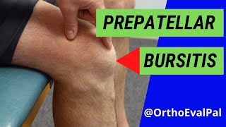 Prepatellar Bursitis Anterior knee pain and swelling [upl. by Uliram893]