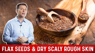 Flaxseed Benefits for Skin amp Symptoms of Linoleic Acid Deficiency – Dr Berg [upl. by Aidnyl]