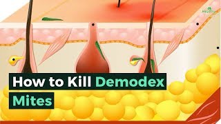 How to Kill Demodex Mites [upl. by Anaeerb]