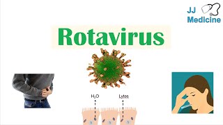 Rotavirus  Risk Factors Pathophysiology Symptoms Diagnosis Treatment [upl. by Ecnerewal]