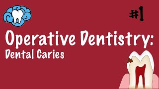 Operative Dentistry  Dental Caries  INBDE ADAT [upl. by Iarised]