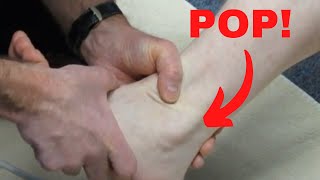 Peroneus longus subluxation How to treat it [upl. by Noryv814]