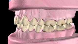 What is Orthodontics [upl. by Ahseined]