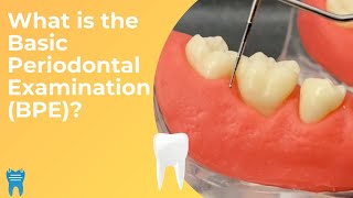 Basic Periodontal Examination BPE  What Why and How [upl. by Neeliak]