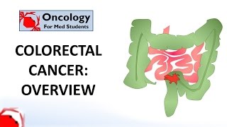 Colorectal Cancer An overview [upl. by Farleigh709]