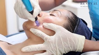 Microneedling Full Training Video [upl. by Gersham]