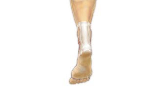 Achilles Tendon Repair Surgery PreOp® Patient Education [upl. by Klos]