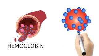 Hemoglobin A1c amp Diabetes [upl. by Hortensa]