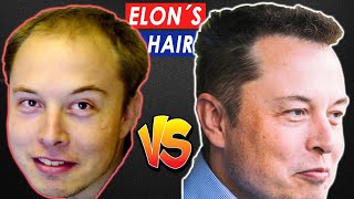 How Elon Musk Got His Hair BACK [upl. by Sair]