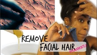 SKIN How to Remove Facial Hair Permanently [upl. by Ettenajna171]