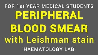 PERIPHERAL BLOOD SMEAR  LEISHMAN STAIN  HAEMATOLOGY LAB  PHYSIOLOGY [upl. by Nylecaj]