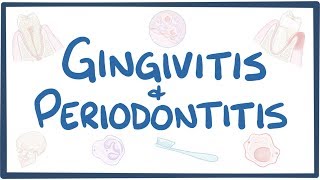 Gingivitis and periodontitis  causes symptoms diagnosis treatment pathology [upl. by Jyoti]