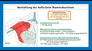 Bestrahlung vom axillären Lymphabflussgebiet beim MammaCa  Strahlentherapie Prof Hilke Vorwerk [upl. by Ytsirhk276]