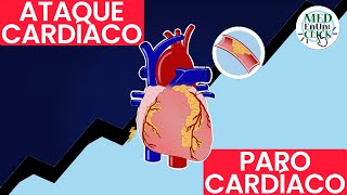 ATAQUE Cardíaco VS PARO Cardíaco [upl. by Genisia]