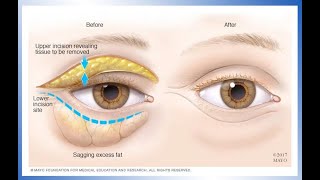 Anatomy of Inner Ear [upl. by Ellehsim]