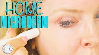 How to do Microdermabrasion at Home DIY [upl. by Conti564]