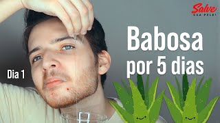 🌿Usei BABOSA no Rosto por 5 DIAS Veja o Resultado [upl. by Aderfla]