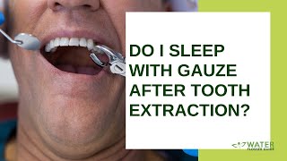 Do I sleep with gauze after tooth extraction [upl. by Mikahs242]