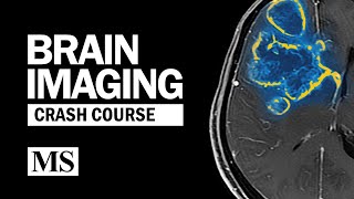 Brain Imaging Crash Course [upl. by Hcirdla]