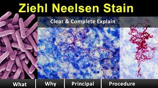 ziehl neelsen Stain  Clear amp Complete Overview [upl. by Atteuqahc]