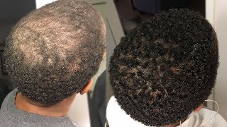 My 100 Natural HAIR GROWTH Serum  2 Month Update  GrowWithMe  Nia Hope [upl. by Devonna299]