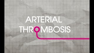 Arterial Thrombosis Explained [upl. by Nomael]