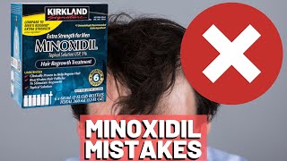 5 BIGGEST MISTAKES When Using Minoxidil REVEALED [upl. by Kavanaugh]