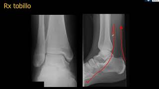 Anatomía Rx Tobillo [upl. by Leonor]
