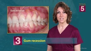 Top 5 Symptoms of Gum Disease [upl. by Jacquelyn]