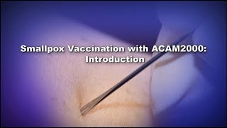 Chapter 1 Smallpox Vaccination with ACAM2000 Introduction [upl. by Vernon]