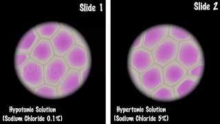 Study of Plasmolysis  MeitY OLabs [upl. by Elitnahc496]