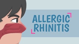 What is Allergic Rhinitis [upl. by Eldwin430]