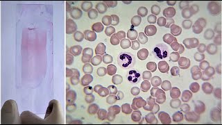 Blood Smear Preparation and Staining Practical Lab [upl. by Stanleigh]