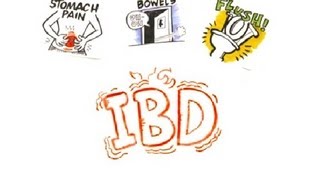 Inflammatory Bowel Disease IBD [upl. by Otaner385]