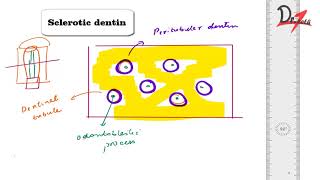 What is Sclerotic dentin [upl. by Ytrebil]