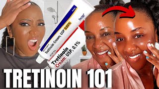 Heres how to PROPERLY Start Tretinoin [upl. by Yazbak]