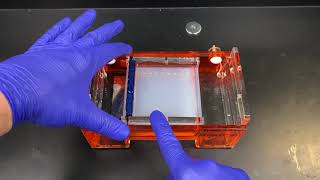 Agarose Gel Electrophoresis [upl. by Kooima]